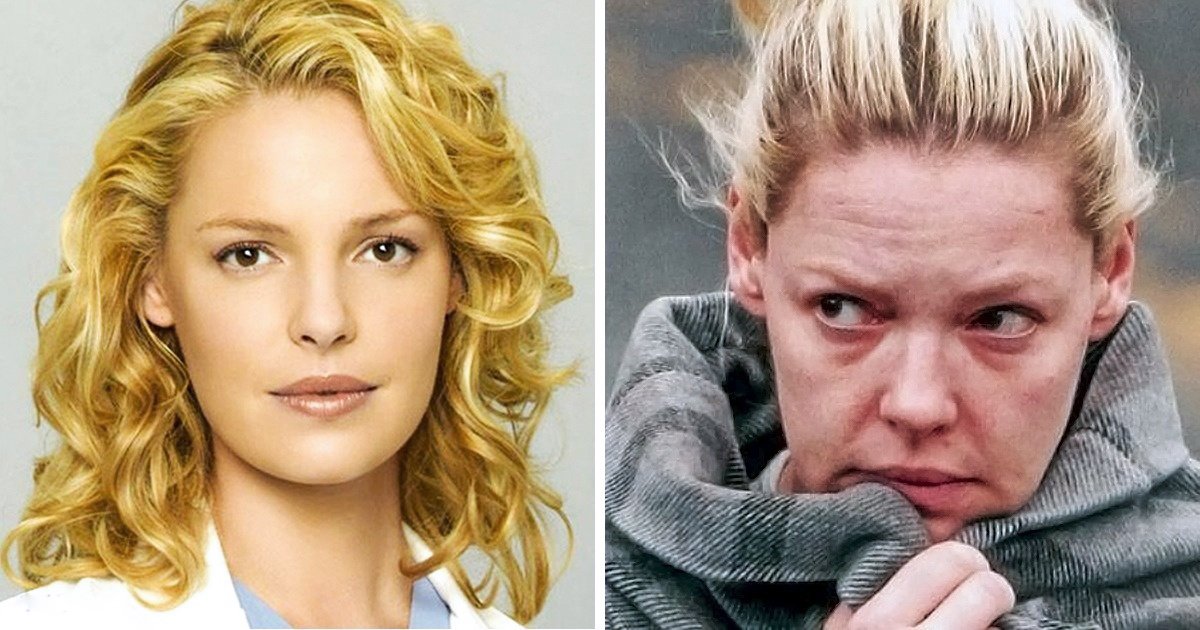 25 Celebrities Who’ve Changed Beyond Recognition